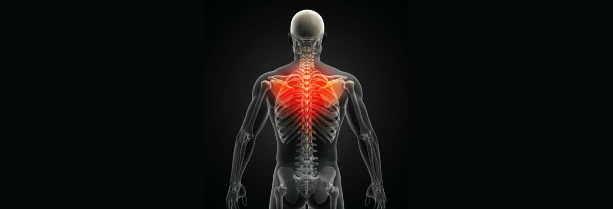 Bodyboard back injury impact zones and spinal pressure areas during bodyboarding